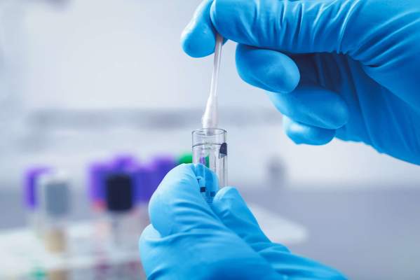 Métabolisme et test ADN - Pour une alimentation adaptée grâce à une analyse de vos gènes ?